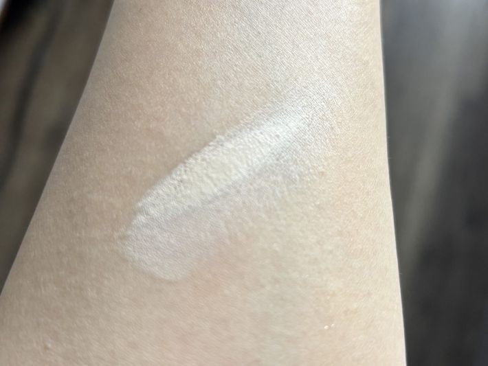 ほうれい線