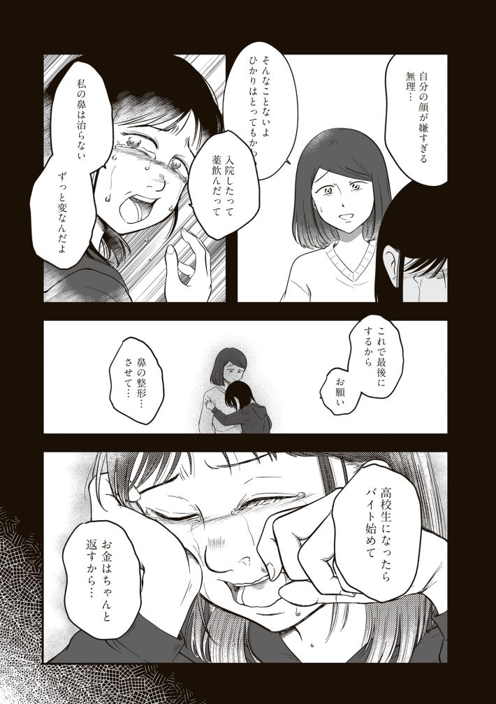 娘に整形したいと言われたら