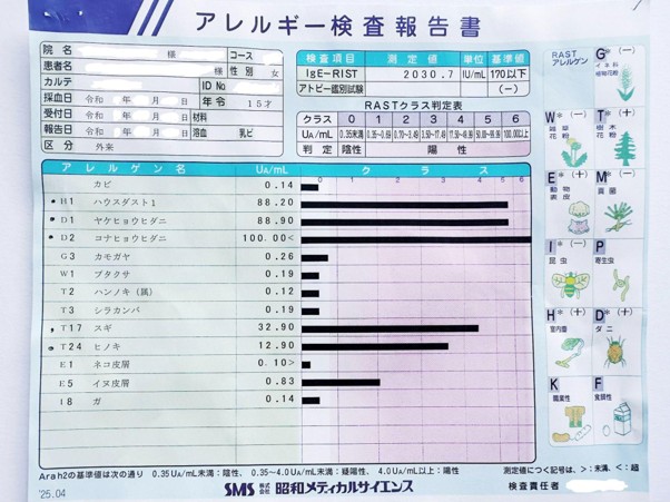 アレルギー検査の結果
