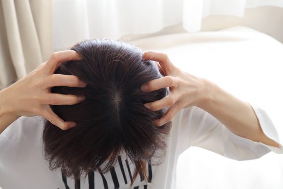 頭皮を気にする女性の悩み