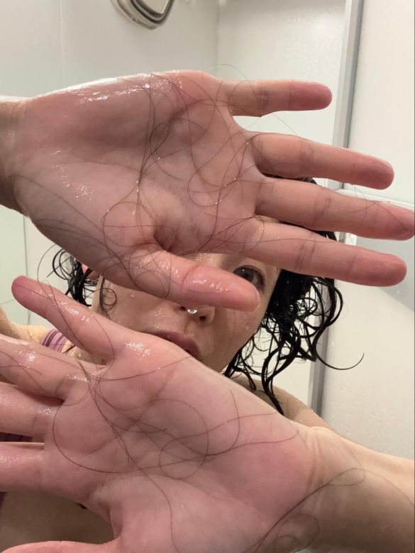 抜け毛が気になる