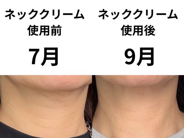 ネッククリーム