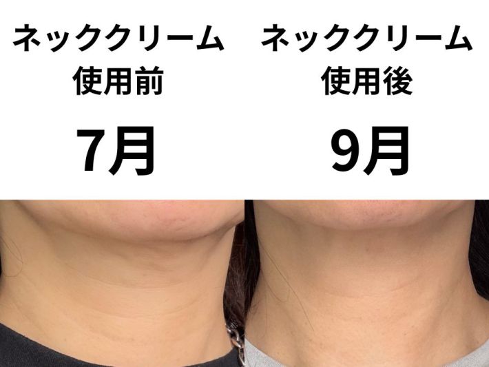 ネッククリーム